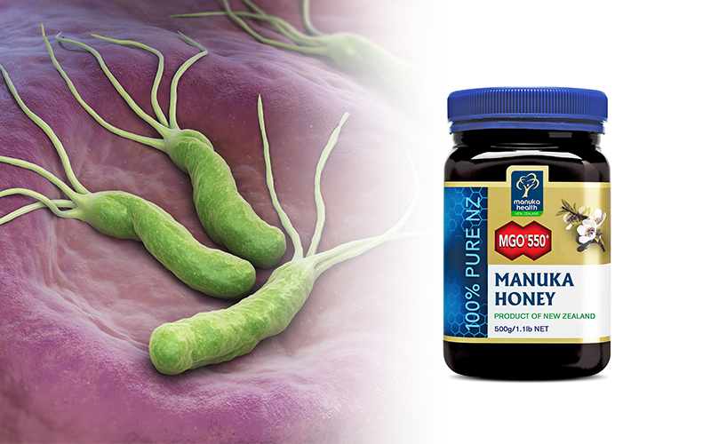 TERMÉSZETES SEGÍTSÉG A HELICOBACTER PYLORI KEZELÉSÉBEN
